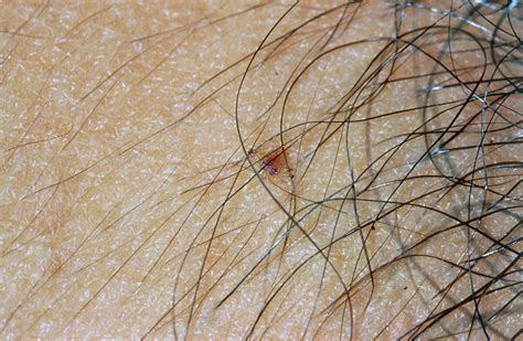 straight pubic hair|Scientific American Blog Network .